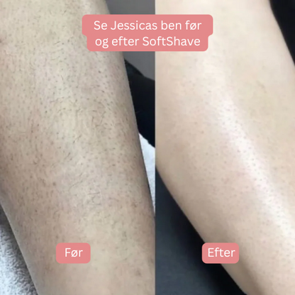 SoftShave™ – For en fejlfri, glat hud uden irritation