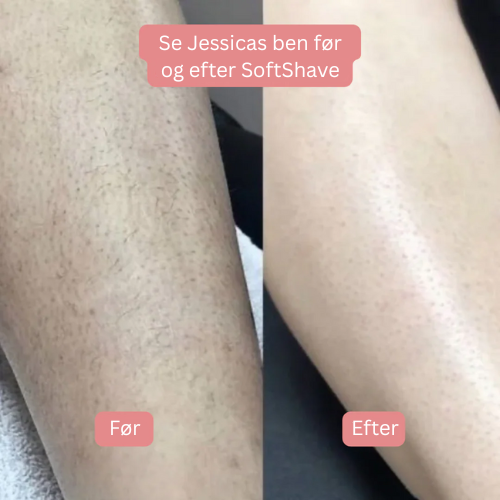 SoftShave™ – For en fejlfri, glat hud uden irritation