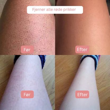 SoftShave™ – For en fejlfri, glat hud uden irritation